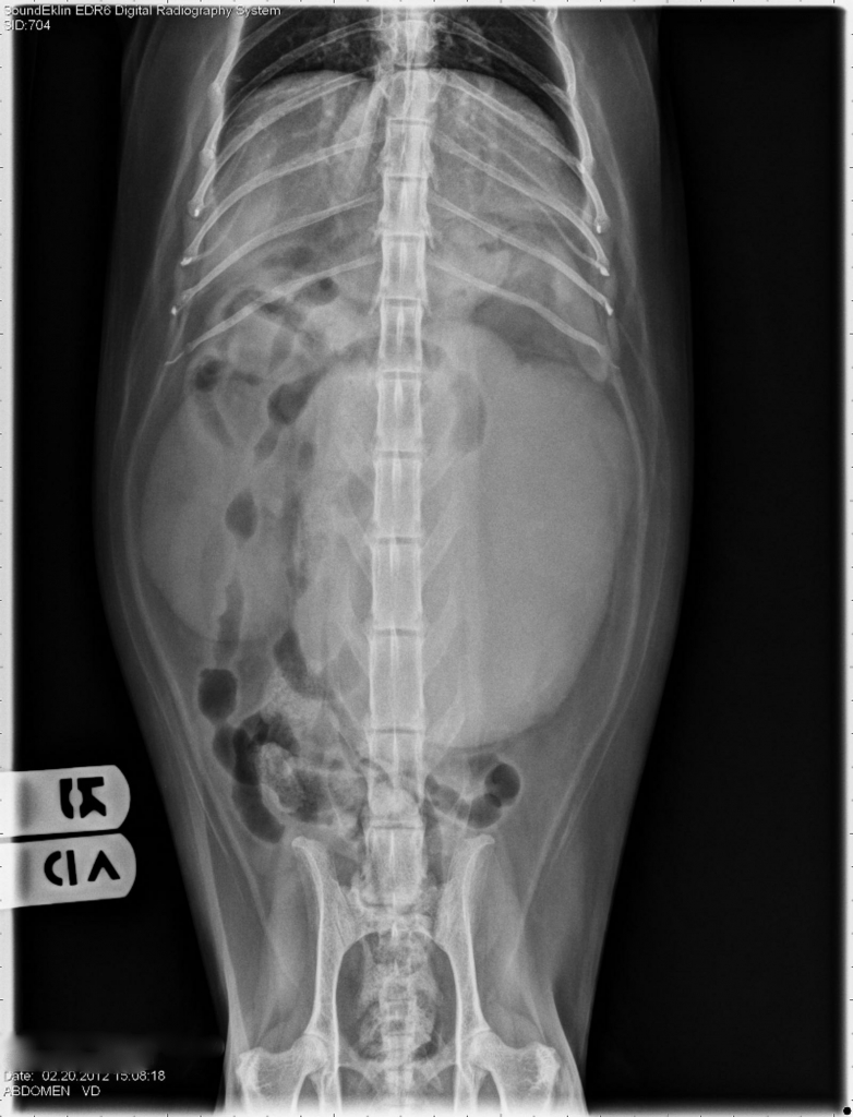 Renal Tumor X-ray