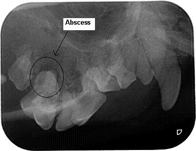 Abscess Radiograph